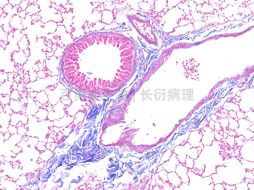 Masson - 小鼠 肺 200倍-86底板.jpg