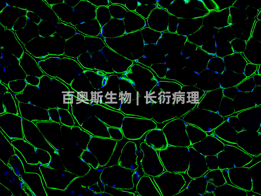 Laminin(green)---腓肠肌---86底板.jpg