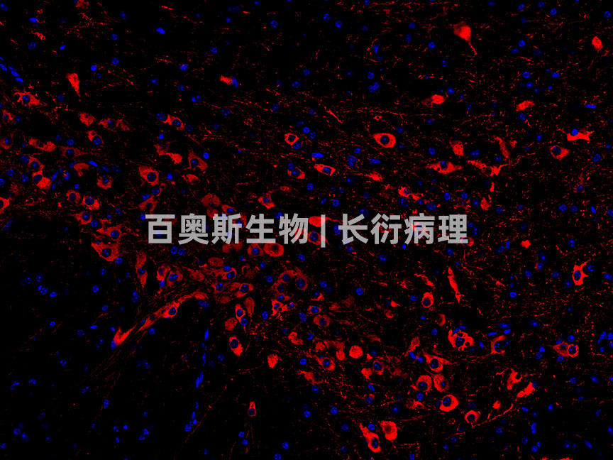 TH(red)---小鼠-脑-200倍---86底板.jpg