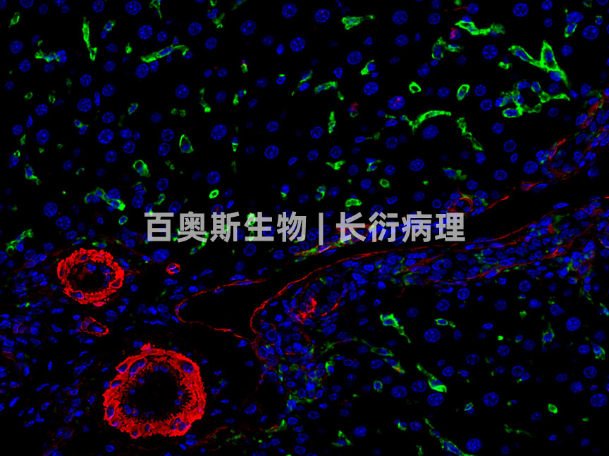 F4-80(green)+α-SMA-(red)---小鼠-肝脏-300倍---86底板.jpg