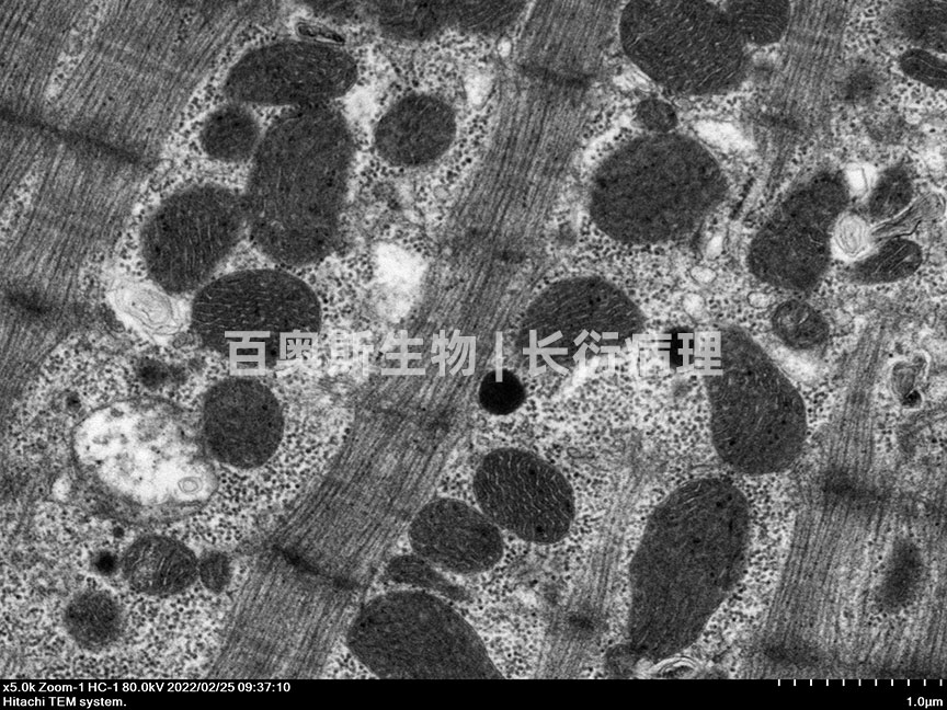 透射电镜---心肌细胞肌节+线粒体---86底板.jpg